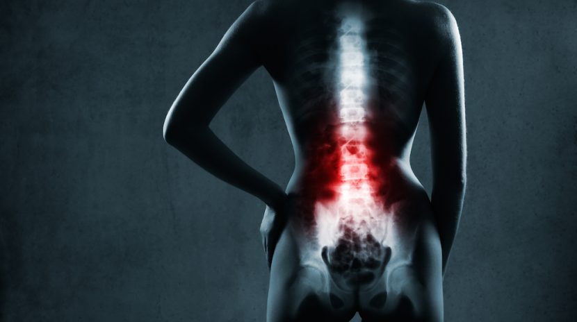 Back Pain After Car Accident